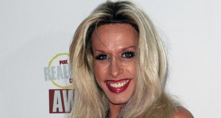 Did Alexis Arquette Die Due to Aids